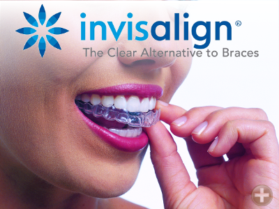InvisAlign